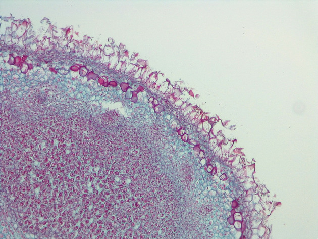 Root Nodule Slides - Root Nodule 03 100X